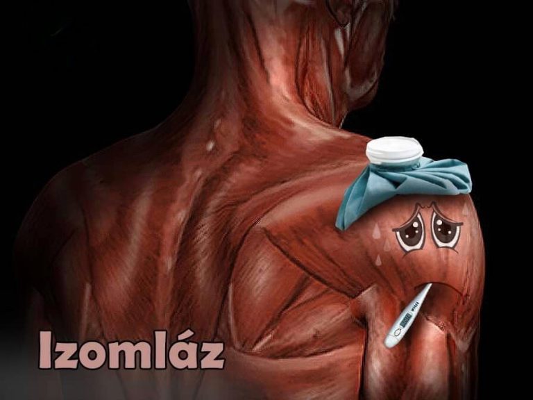 Izomlázra szükséged van az izomfejlődéshez?